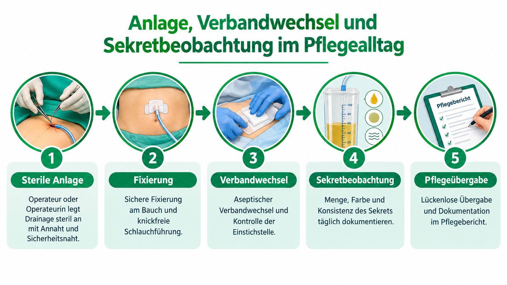 Infografik zum Prozess der Anlage, Verbandwechsel und Sekretbeobachtung von Bauchdrainagen in der professionellen Pflege und medizinischen Versorgung.
