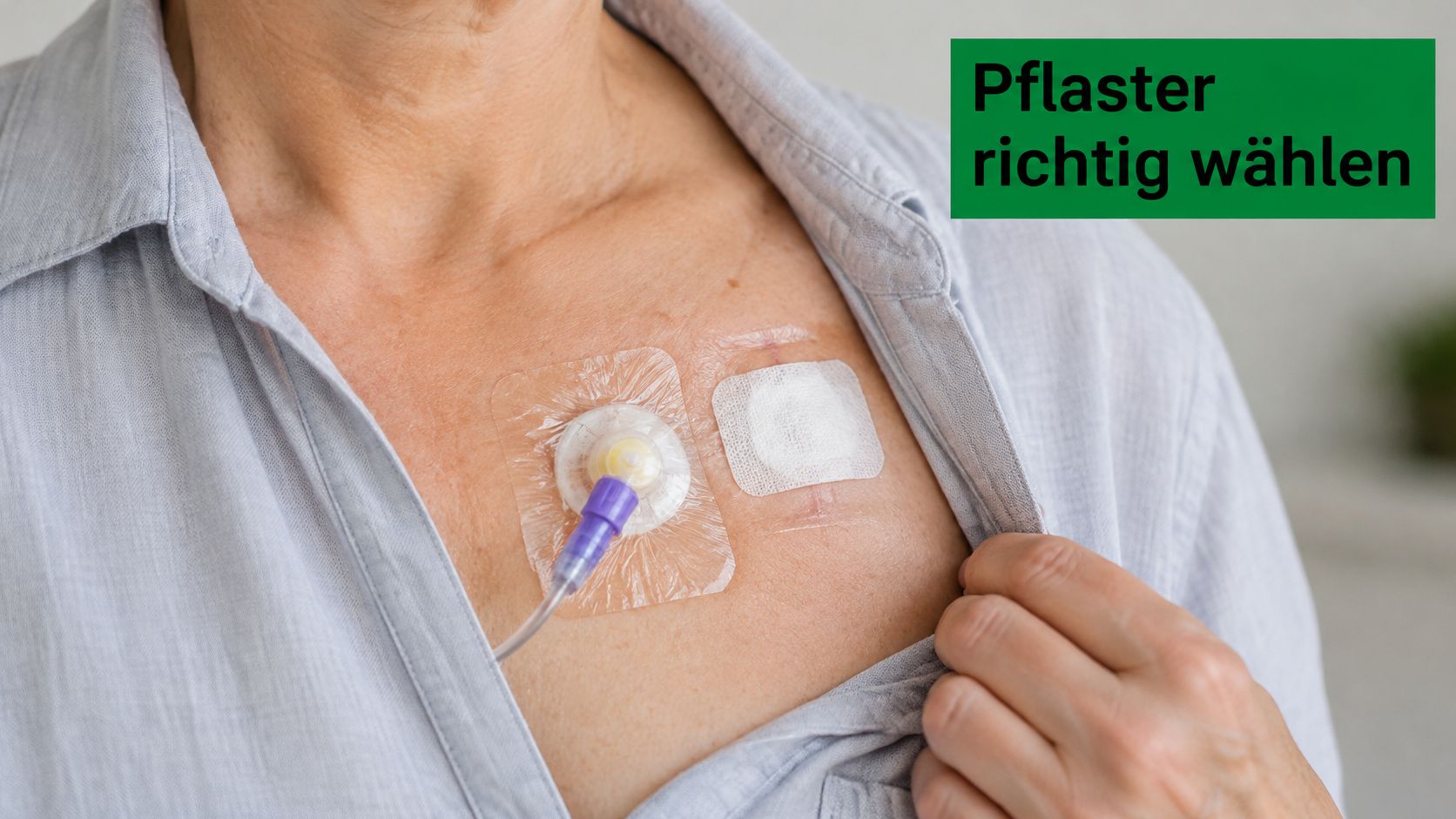 Eine Frau mit implantiertem Port-Katheter auf der Brust, der mit einem transparenten Verband und Pflaster abgedeckt ist.