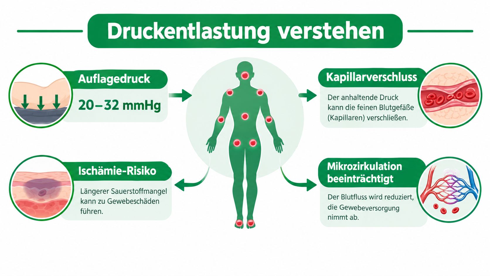 Eine Infografik zur Erklärung von Dekubitus, die zeigt, wie Druck die Durchblutung behindert und Gewebeschäden verursacht.